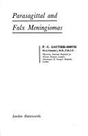 Cover of: Parasagittal and falx meningiomas by P. C. Gautier-Smith