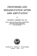 Prostheses and rehabilitation after arm amputation by Leonard F. Bender