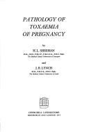 Pathology of toxaemia of pregnancy by H. L. Sheehan