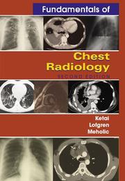 Cover of: Fundamentals of chest radiology