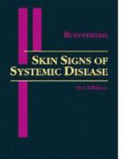 Skin signs of systemic disease by Irwin M. Braverman