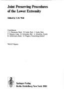 Cover of: Joint Preserving Procedures by Weil