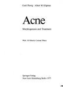 Cover of: Acne: morphogenesis and treatment