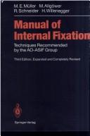 Cover of: Manual of Internal Fixation by Robert L. Schneider, M. E. Muller, Martin Allgower, Robert Schneider, H. Willenegger