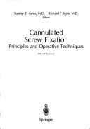 Cannulated screw fixation