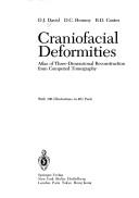 Cover of: Craniofacial deformities: atlas of three dimensional reconstruction from computed tomography