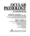 Ocular pathology by Myron Yanoff, Ben S. Fine