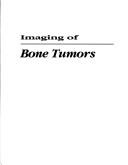Cover of: Imaging of bone tumors: a multimodality approach