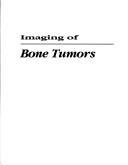 Cover of: Imaging of Bone Tumors by George B. Greenfield