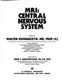 Cover of: MRI: central nervous system