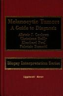 Melanocytic tumors by Alistair J. Cochran