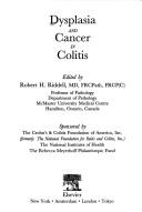 Cover of: Dyspasia and Cancer in Colitis