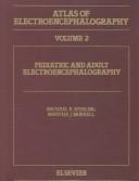 Intracranial electroencephalography by Michael R. Sperling