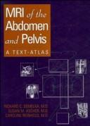 Cover of: MRI of the abdomen and pelvis: a text-atlas