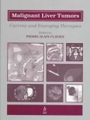 Cover of: Malignant liver tumors: current and emerging therapies