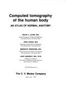 Cover of: Computed tomography of the human body by Ralph J. Alfidi ... [et al.].