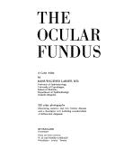 Cover of: The ocular fundus: a color atlas