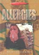 Cover of: Allergies (Health Issues)