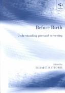 Cover of: Before Birth: Understanding Prenatal Screening
