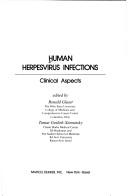 Cover of: Human herpesvirus infections by edited by Ronald Glaser, Tamar Gotlieb-Stematsky.
