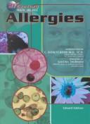 Cover of: Allergies (21st Century Health and Wellness)