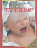 The First Test Tube Baby by Fiona MacDonald