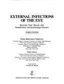 External infections of the eye by Helena Biantovskaya Fedukowicz, Susan Stenson