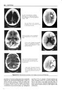 Correlative neuroanatomy by J. De Groot, Jack deGroot, Joseph G. Chusid