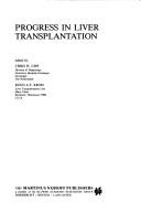 Cover of: Progress in liver transplantation