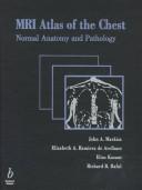 Cover of: MRI atlas of the chest: normal anatomy and pathology