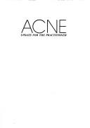 Cover of: Acne by edited by Samuel B. Frank.