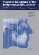 Cover of: Magnetic resonance of the temporomandibular joint: clinical considerations, radiography, management