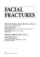 Cover of: Facial Fractures by Mutaz B. Habal, Mutaz B. Habal