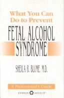 Cover of: What you can do to prevent fetal alcohol syndrome | Sheila B. Blume