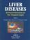 Cover of: Liver Diseases