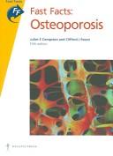 Cover of: Fast Facts Osteoporosis (Fast Facts)