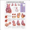 Cover of: Cardiovascular Disease Anatomical Chart | Anatomical Chart Company