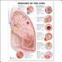 Cover of: Diseases of the Lung Anatomical Chart