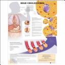 Cover of: High Cholesterol Anatomical Chart