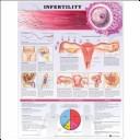 Cover of: Infertility Anatomical Chart | Anatomical Chart Company