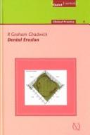 Cover of: Dental Erosion (Quintessentials of clinical Practice) by R. Graham Chadwick