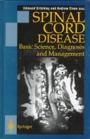 Cover of: Spinal Cord Disease: Basic Science, Diagnosis and Management