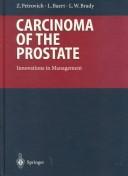 Carcinoma of the prostate by Zbigniew Petrovich