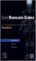 Cover of: Serie Pocket de Radiologia: Los 100 diagnosticos principales en cerebro (Serie Pocket De Radiologia)