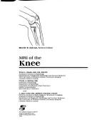 Cover of: Mri of the Knee (Clinical Diagnostic Imaging Series)