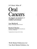 Cover of: A Colour Atlas of Oral Cancers: The Diagnosis and Classification of Leukoplakias, Precancerous Conditions and Carcinomas (Wolfe Medical Atlases)
