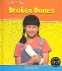 Cover of: Broken Bones by 