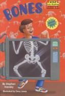 Cover of: Bones (Step Into Reading: A Step 1 Book) by Stephen Krensky