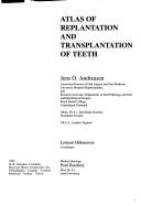 Atlas of Replantation and Transplantation of Teeth by Andreasen