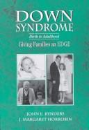 Cover of: Down's Syndrome: Birth to Adulthood : Giving Families an Edge